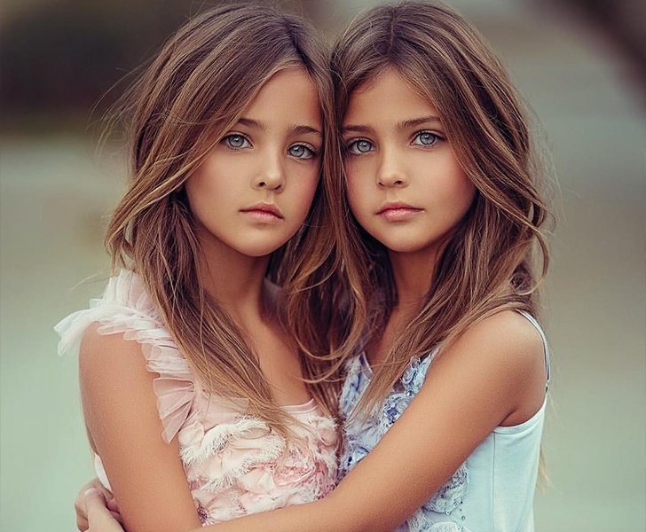 Most Beautiful Twins In The World So Much Beauty That It Hurts